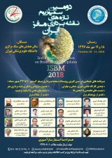 پوستر دومین سمپوزیوم تازه های نقشه برداری مغز ایران